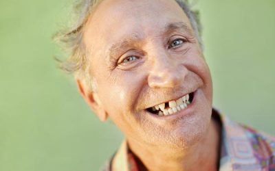 Should You Consider Dental Implants When You Have A Missing Tooth?