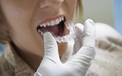Using Invisalign to Straighten Your Teeth