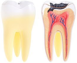 Dental Abscess Emergency | Dentist Forster