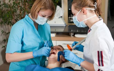 The Top Benefits of Tooth-Colored Dental Fillings