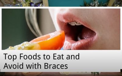 Top Foods to Eat and Avoid with Braces from Forster Dental Centre